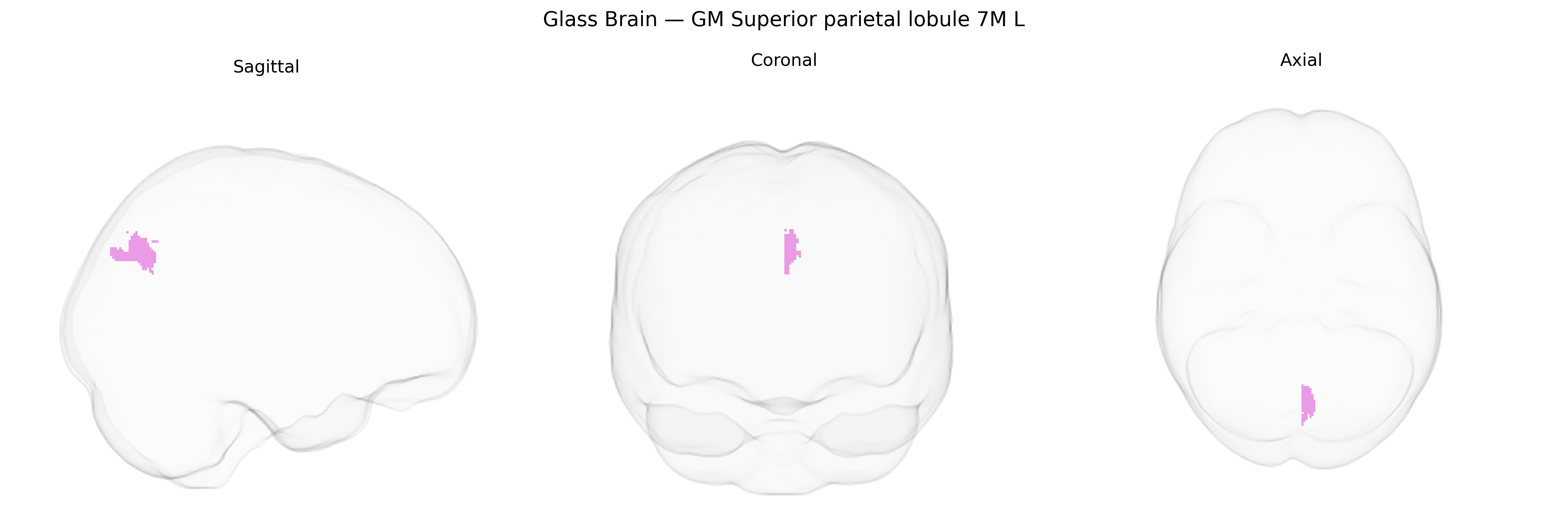 Triplanar Ghost Brain