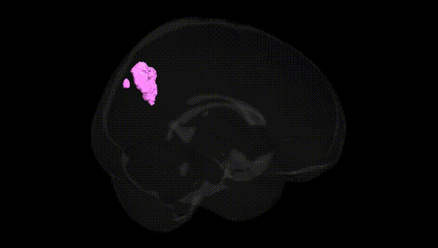 Full Brain Black