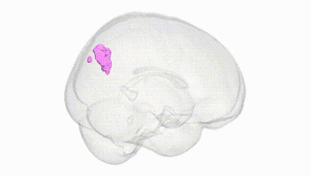 Full Brain White