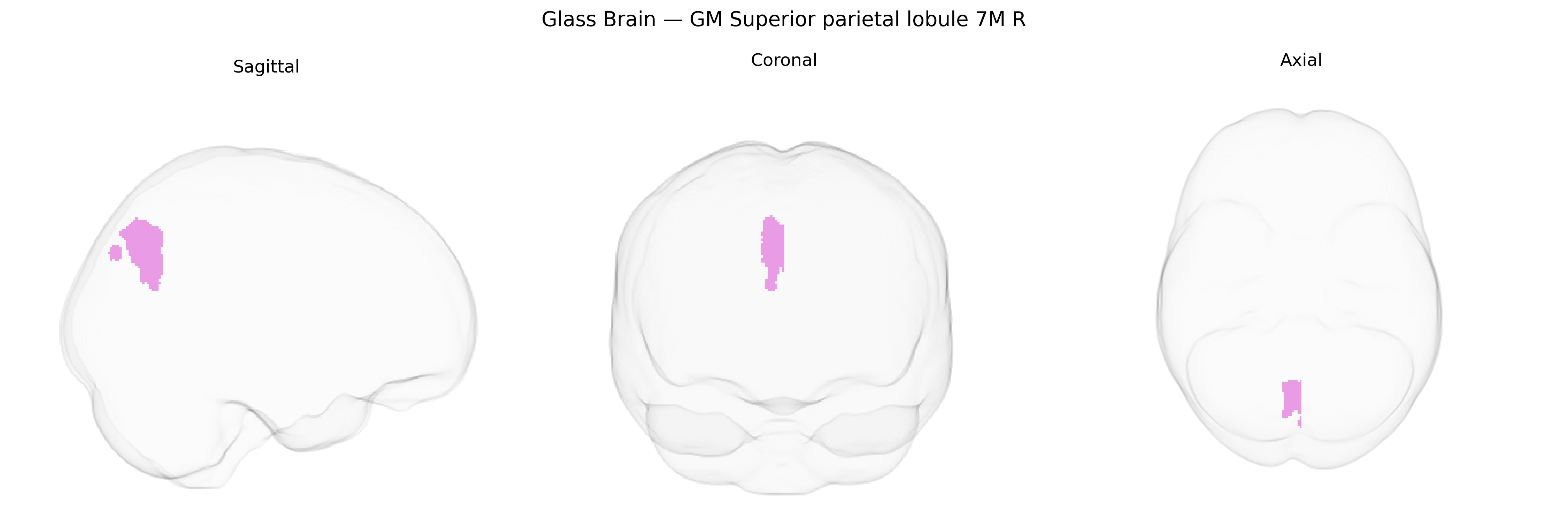 Triplanar Ghost Brain
