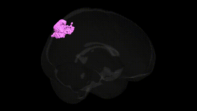 Full Brain Black