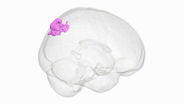 Full Brain White