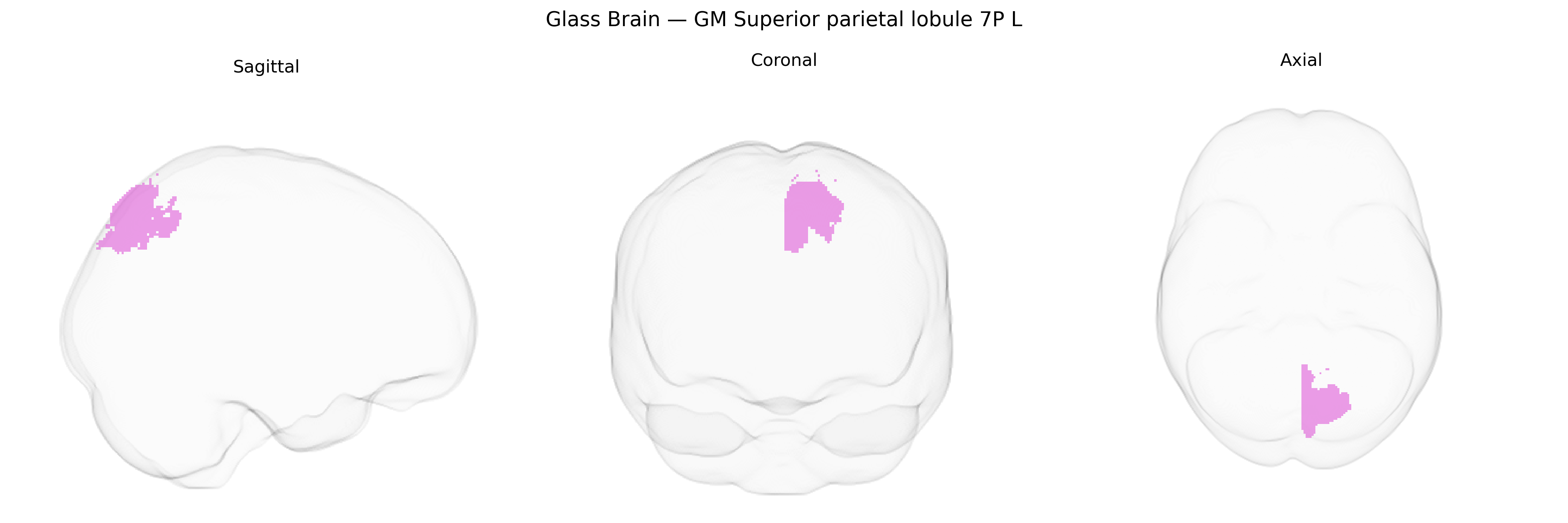 Triplanar Ghost Brain