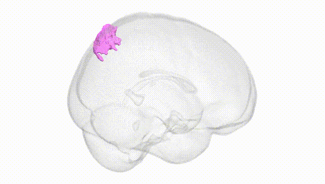 Full Brain White