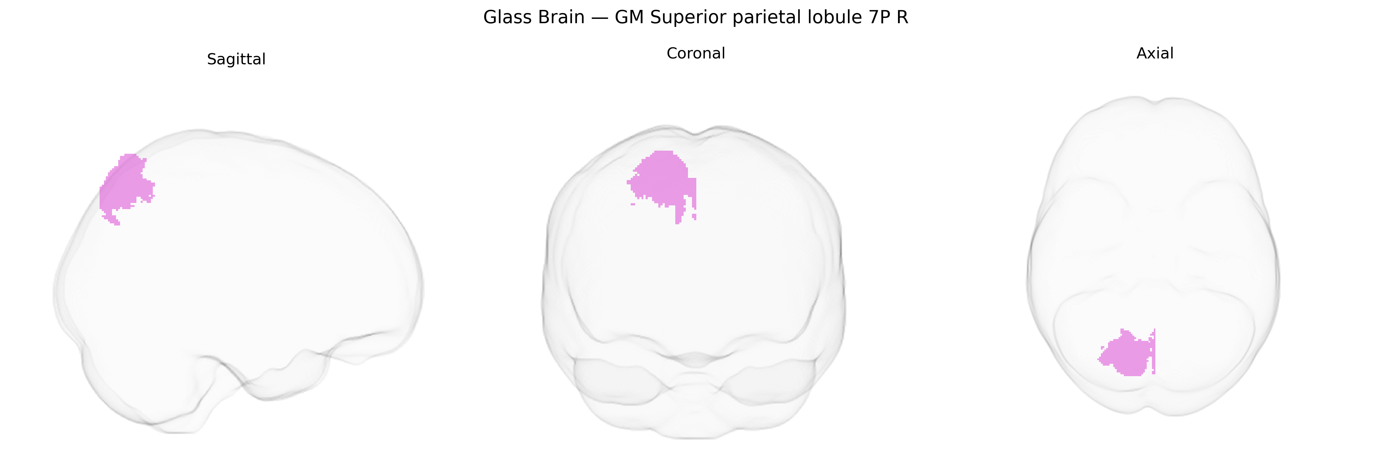 Triplanar Ghost Brain