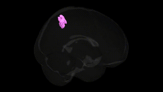 Full Brain Black