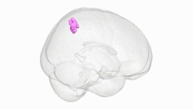 Full Brain White