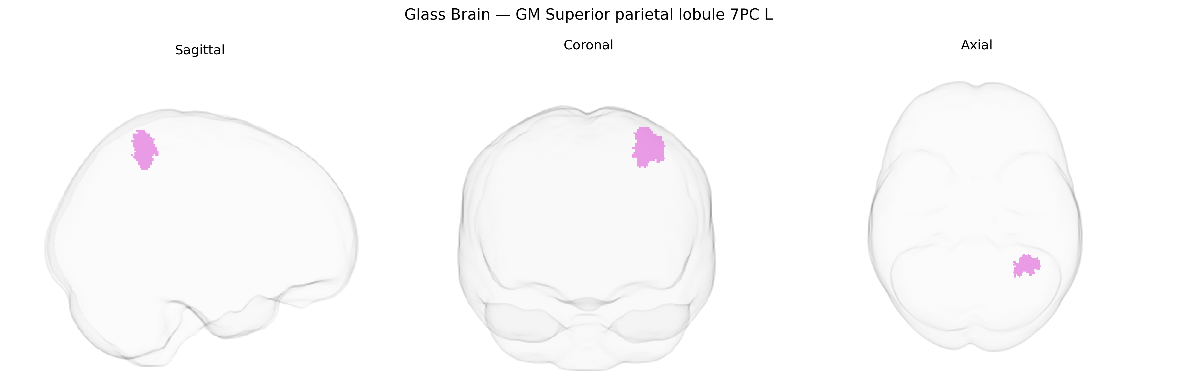 Triplanar Ghost Brain