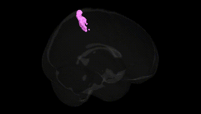 Full Brain Black