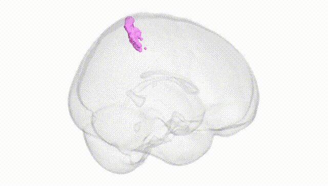 Full Brain White
