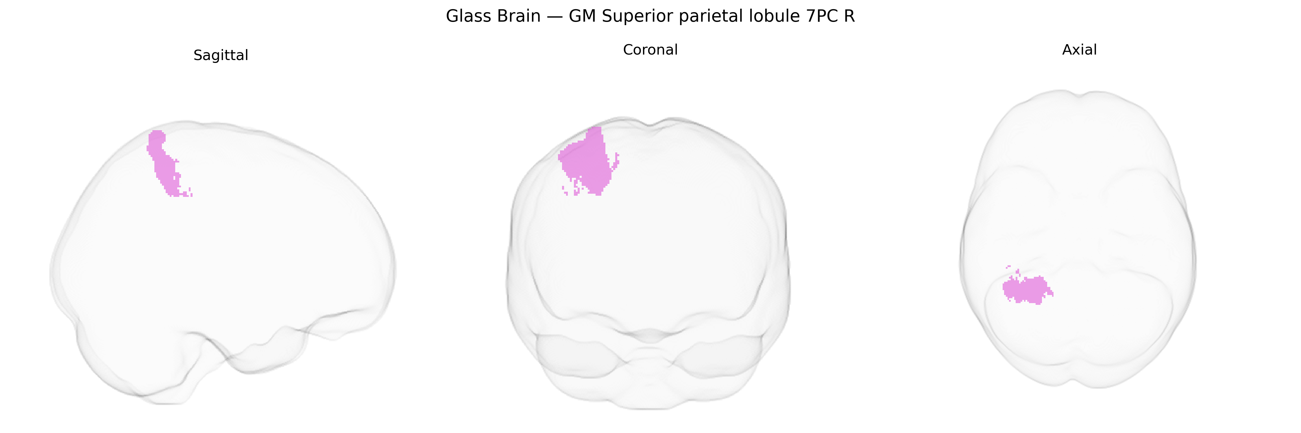 Triplanar Ghost Brain