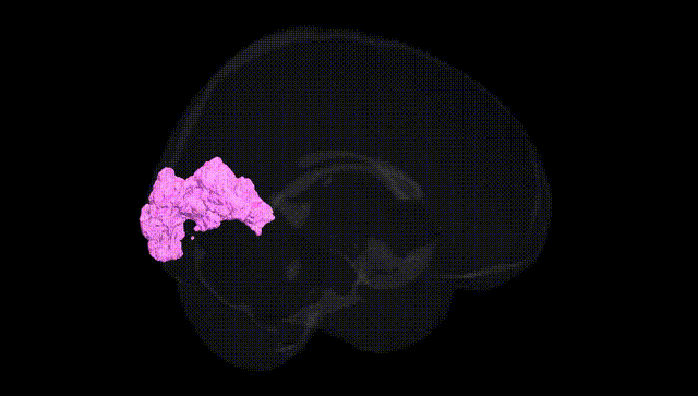Full Brain Black