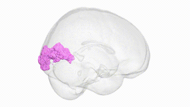 Full Brain White