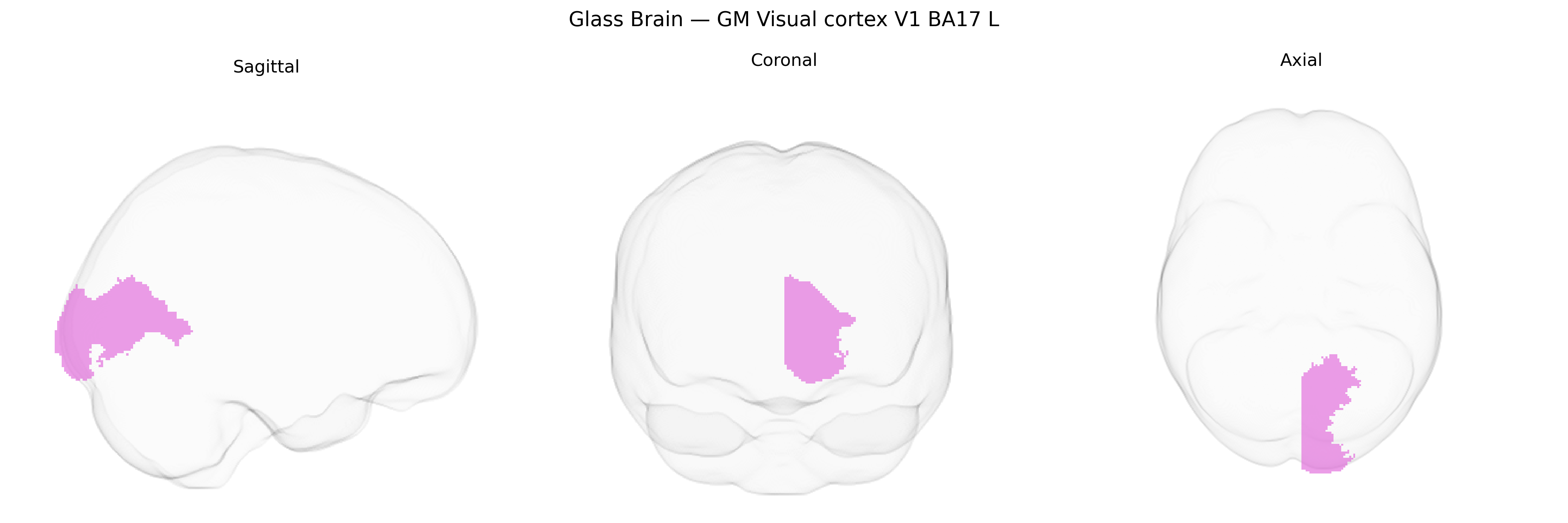 Triplanar Ghost Brain
