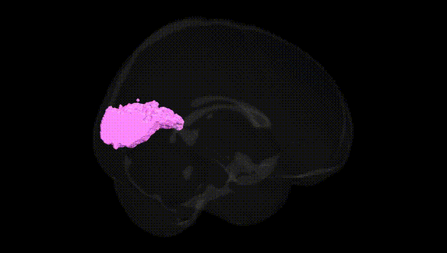 Full Brain Black