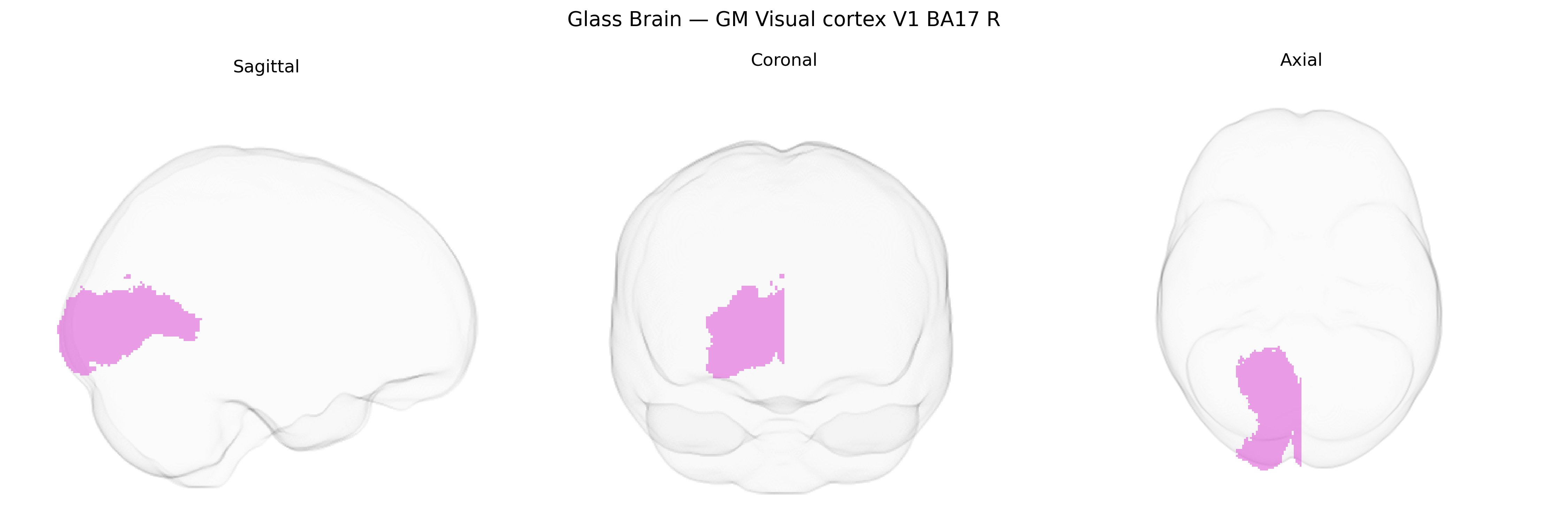 Triplanar Ghost Brain
