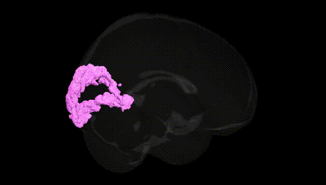 Full Brain Black