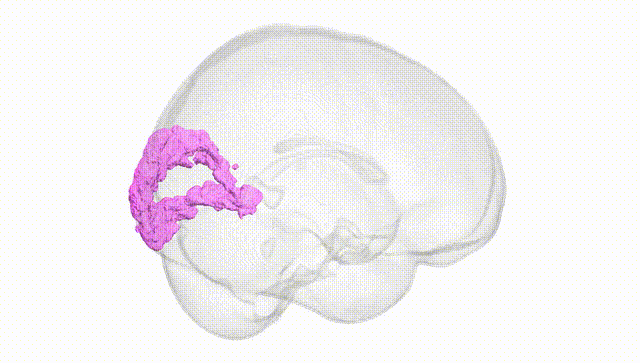 Full Brain White