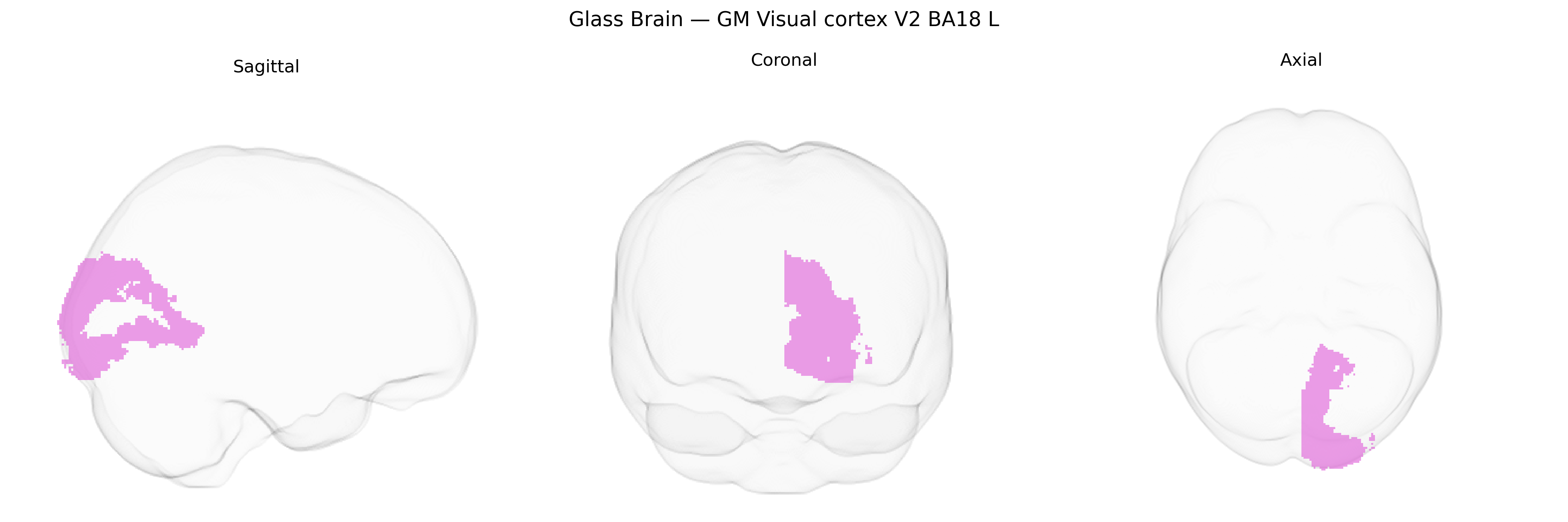 Triplanar Ghost Brain
