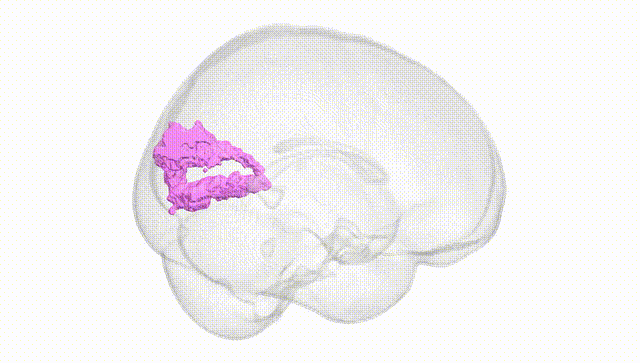 Full Brain White
