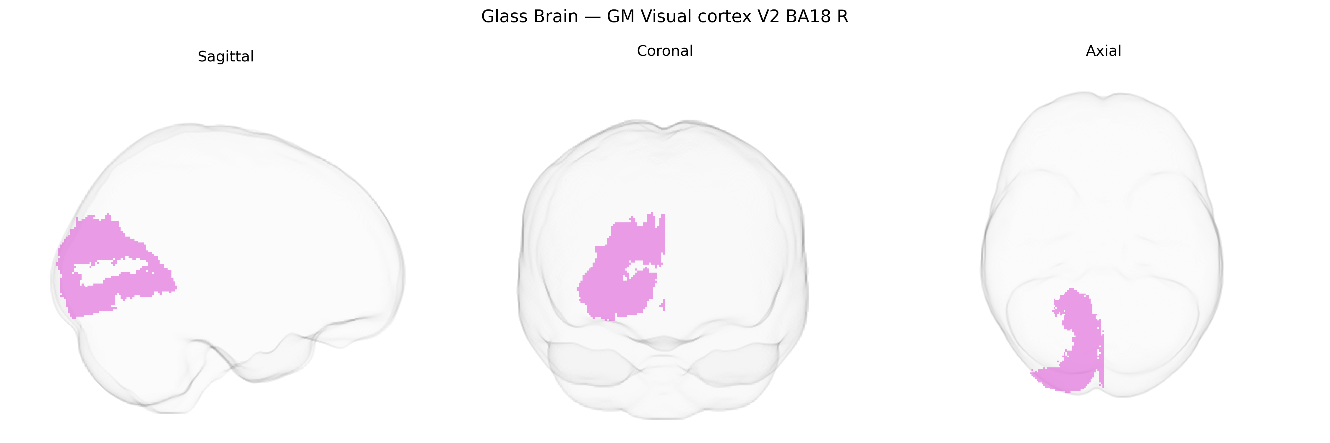 Triplanar Ghost Brain