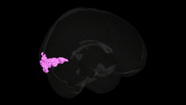 Full Brain Black