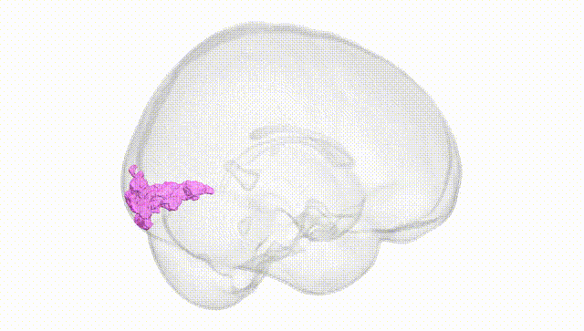 Full Brain White