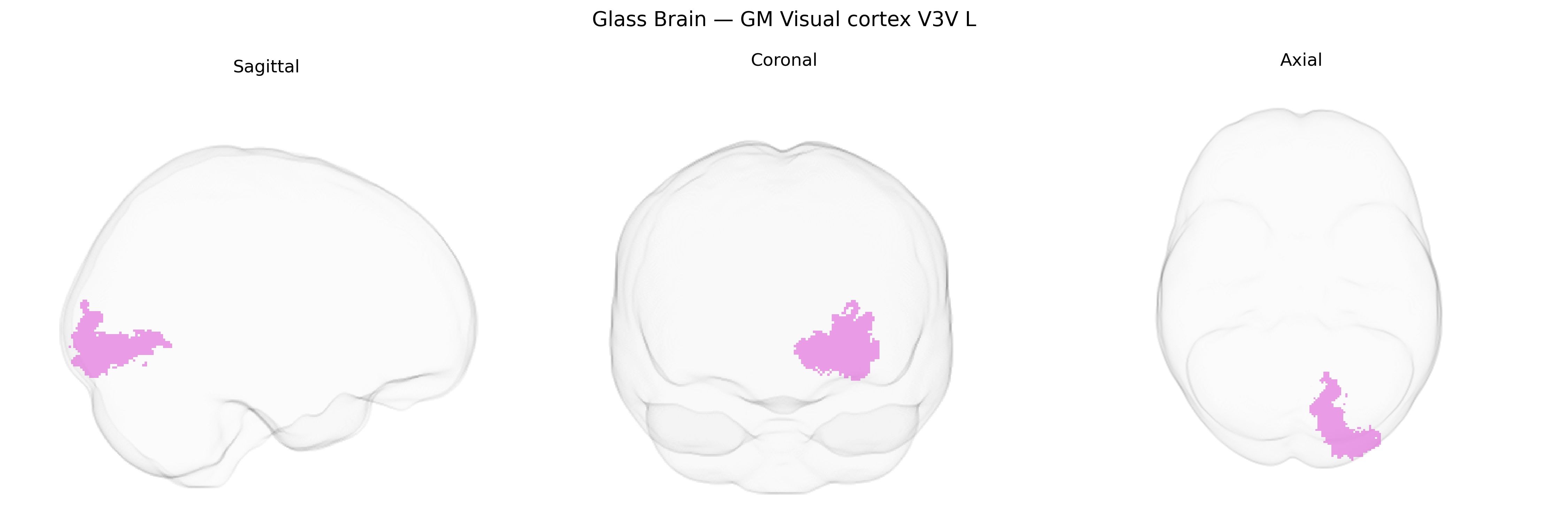 Triplanar Ghost Brain