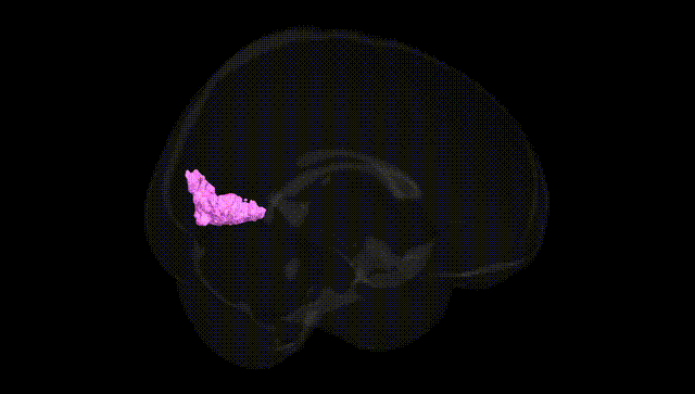 Full Brain Black