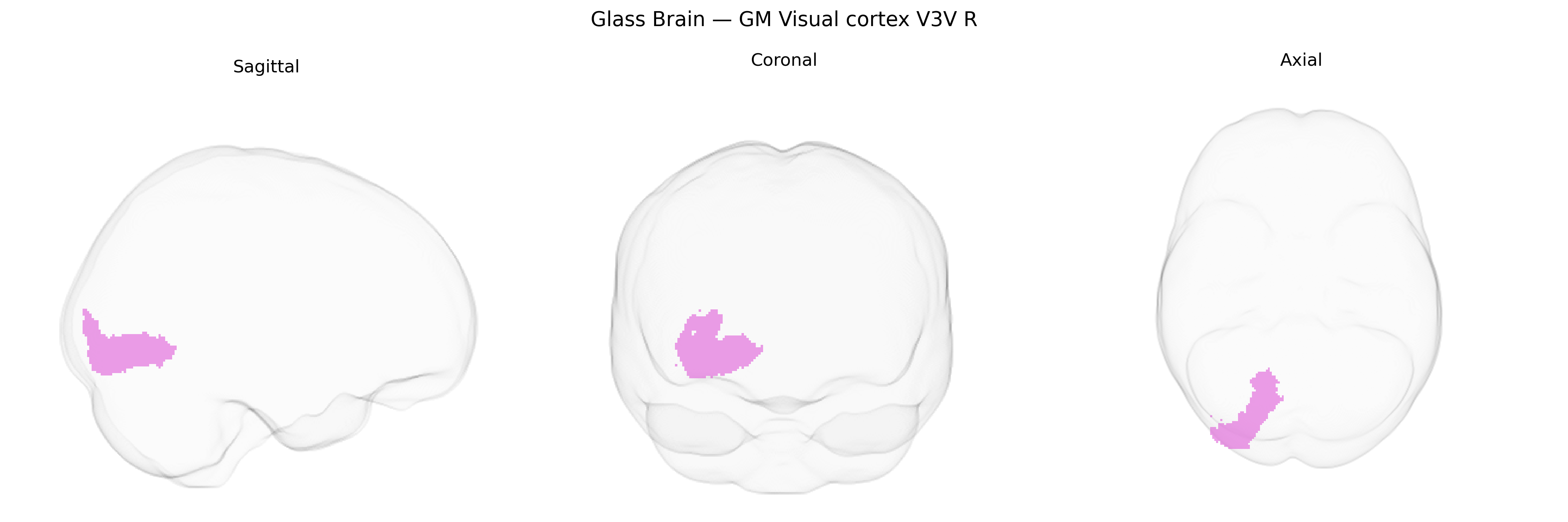 Triplanar Ghost Brain
