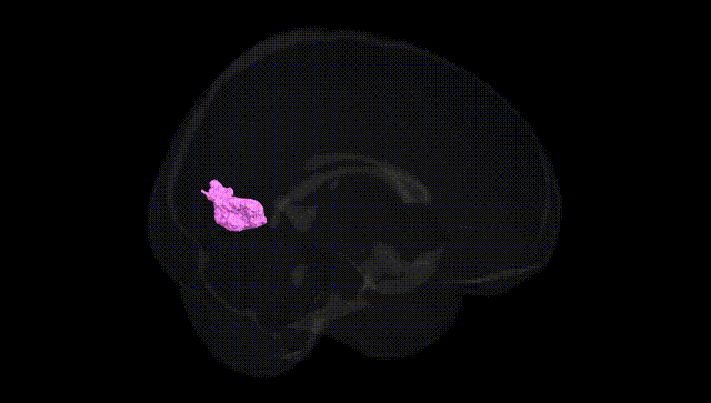 Full Brain Black