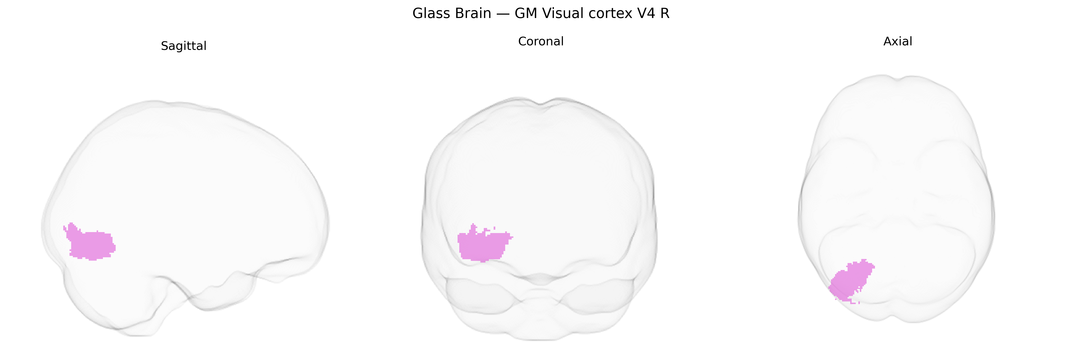Triplanar Ghost Brain