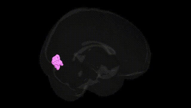 Full Brain Black