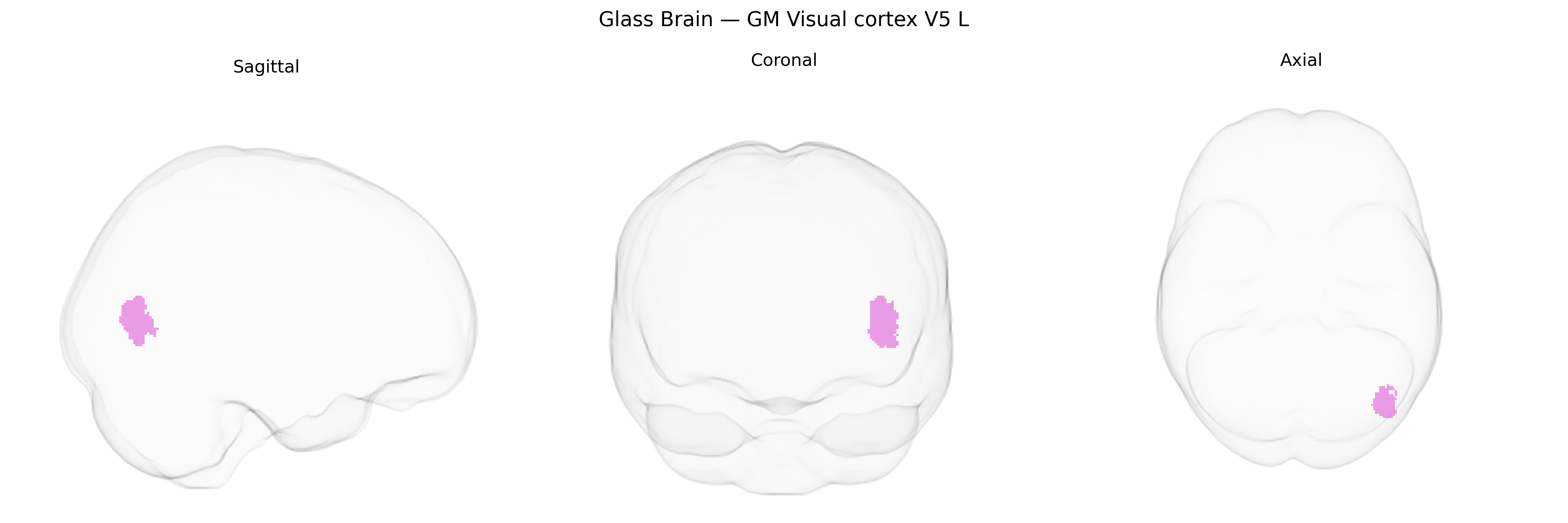 Triplanar Ghost Brain