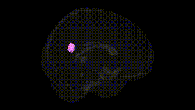 Full Brain Black