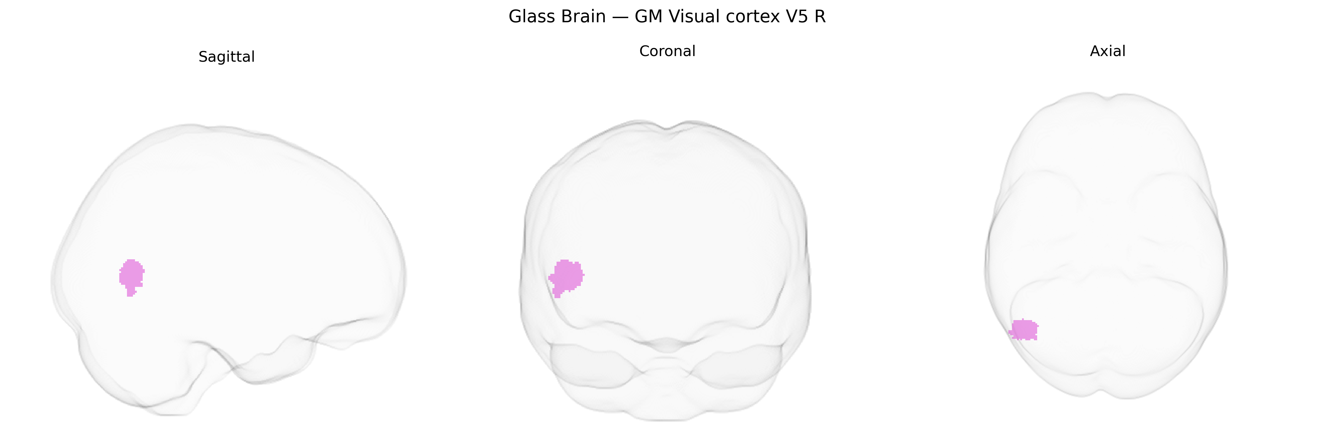 Triplanar Ghost Brain