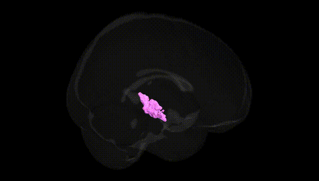 Full Brain Black