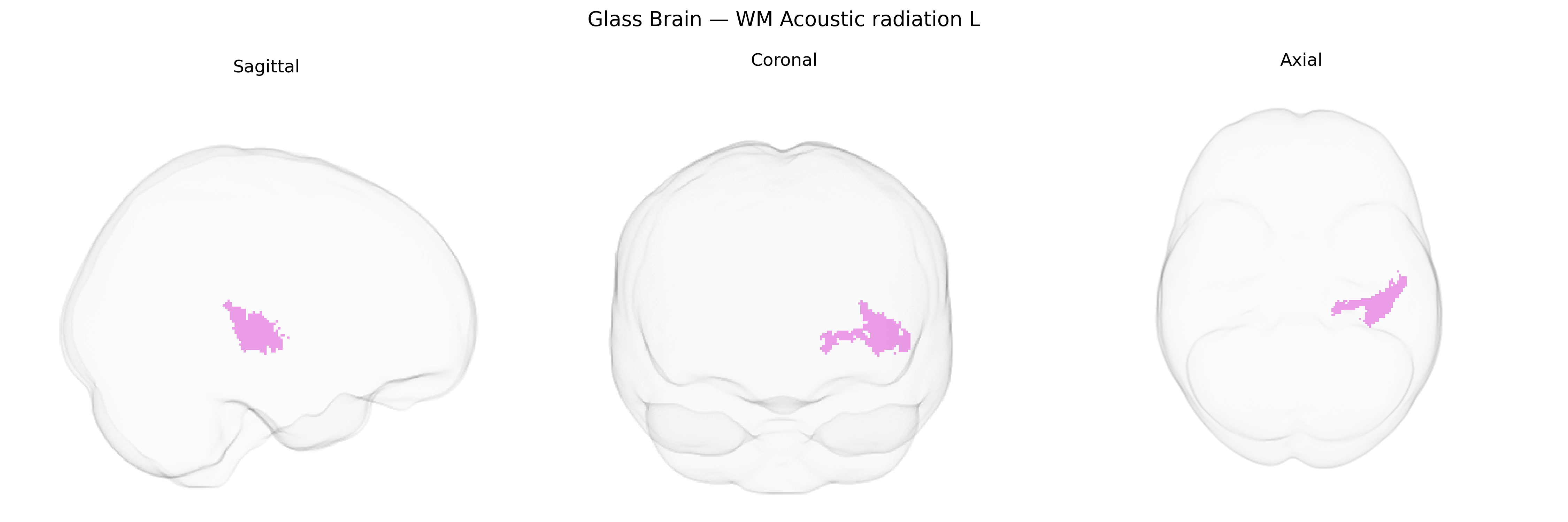 Triplanar Ghost Brain