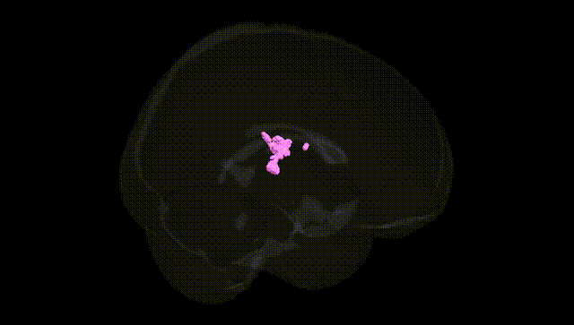 Full Brain Black