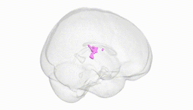 Full Brain White