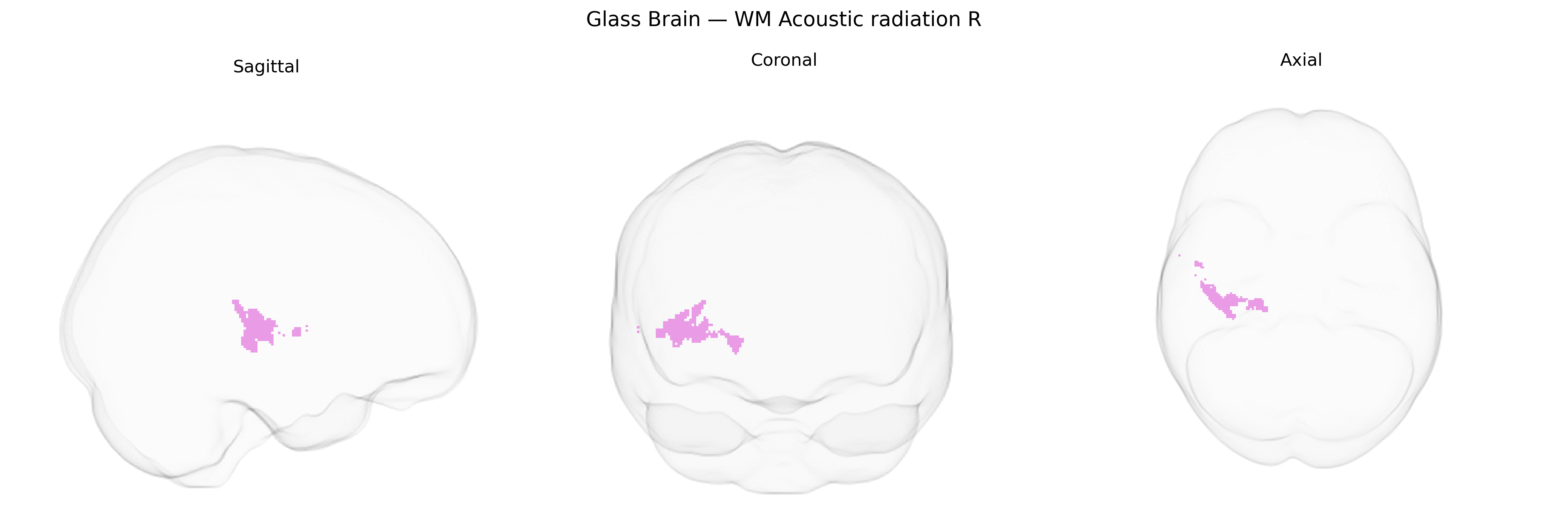 Triplanar Ghost Brain