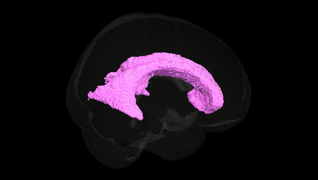 Full Brain Black