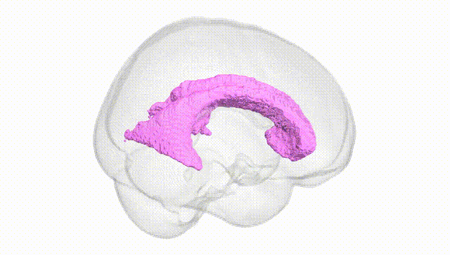 Full Brain White