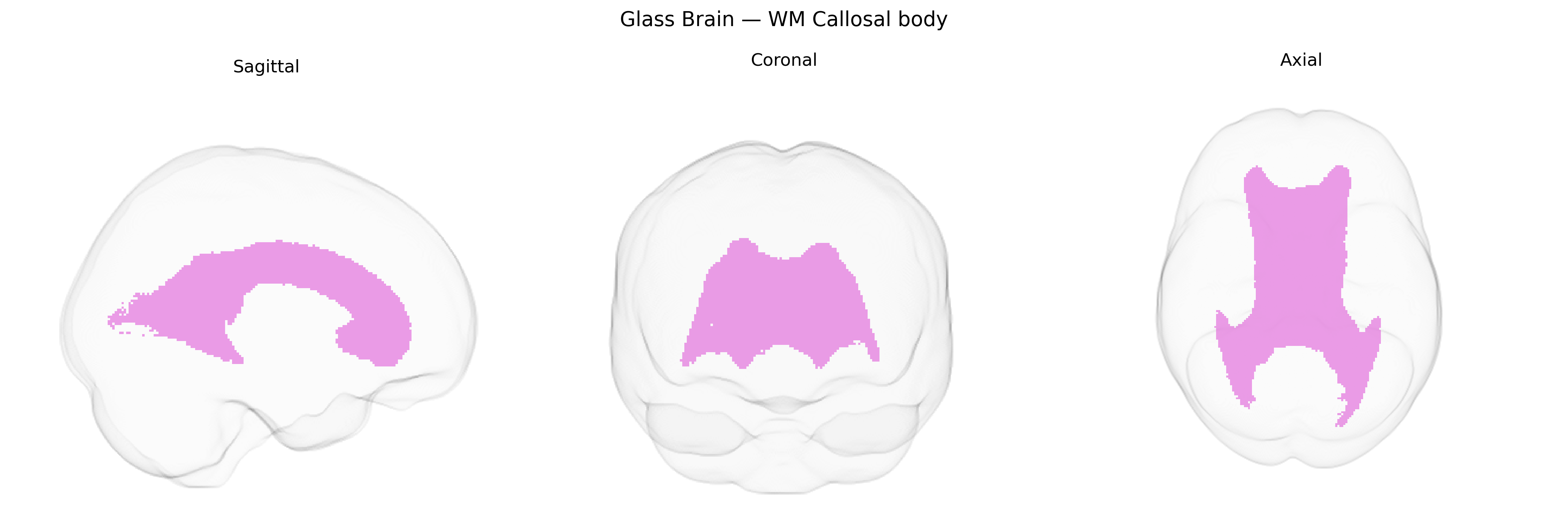 Triplanar Ghost Brain