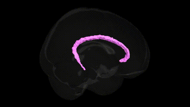Full Brain Black