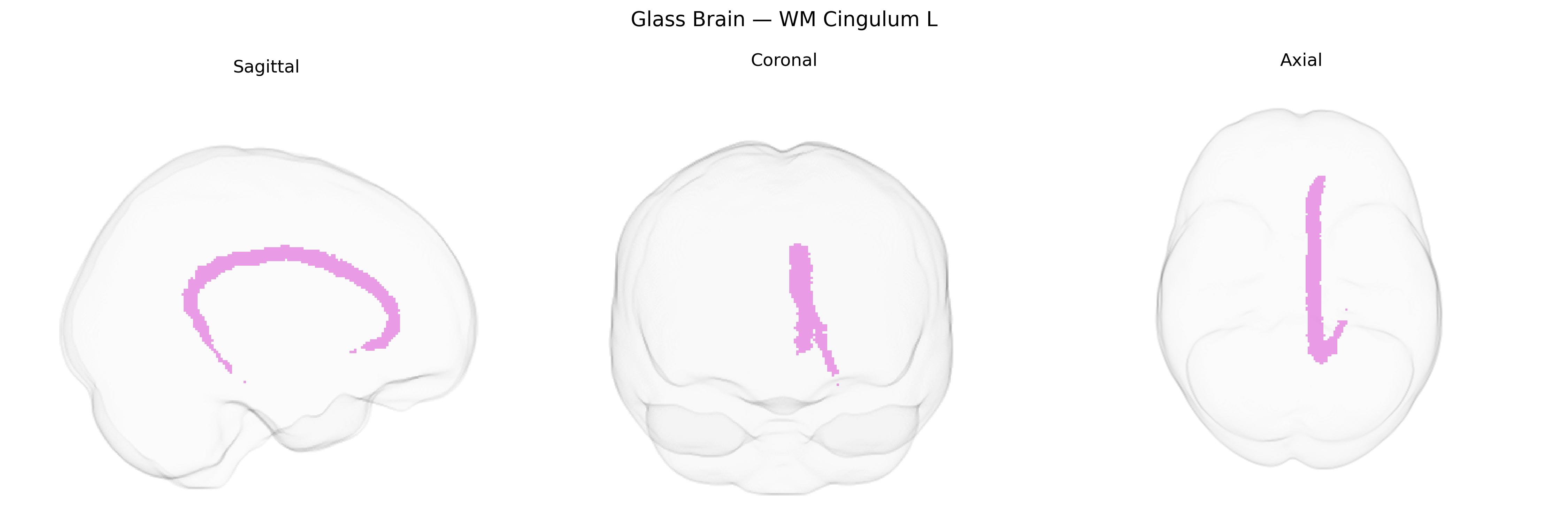 Triplanar Ghost Brain