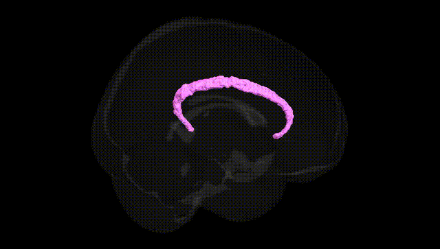 Full Brain Black