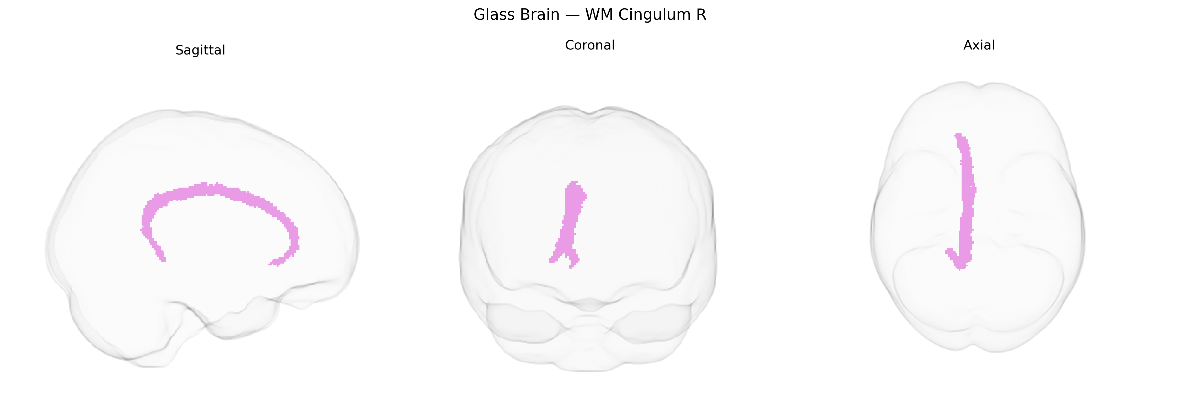 Triplanar Ghost Brain