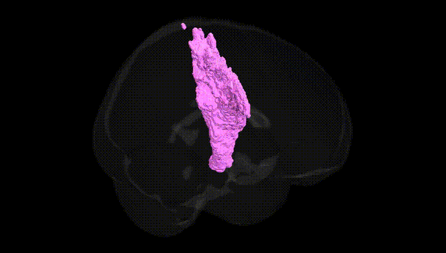 Full Brain Black
