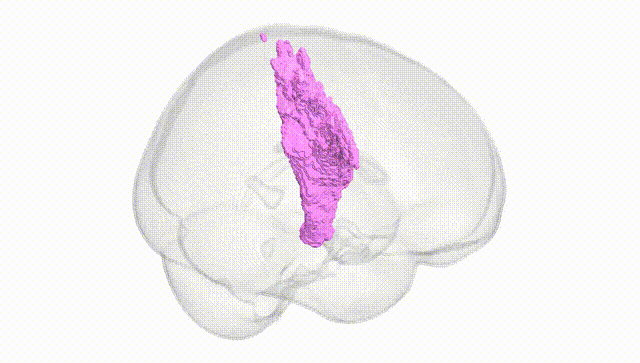 Full Brain White